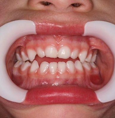 Pistas Diretas Planas